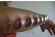 62 Insane Body Modifications