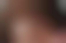 Facial Paralysis Portraits