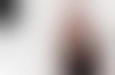 Cosmetic Surgery Diaries
