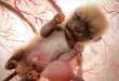 21 Incredible Fetal Innovations