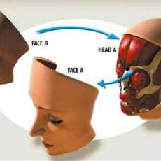 French Woman Receives Face Transplant