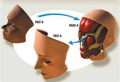 French Woman Receives Face Transplant