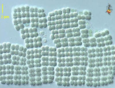 16 Year Old Produces Electricity from Magnetic Bacteria