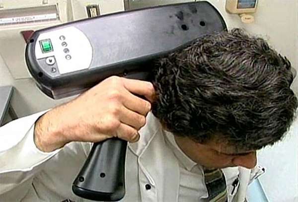 Migraine Zapper
