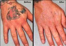 Removable Tattoos