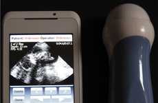 Smartphone Ultrasound Systems