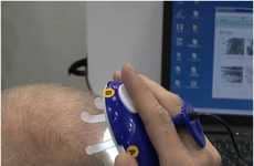 USB Scalp Analyzers