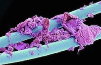 Amazing Microscopic Photography Image 8