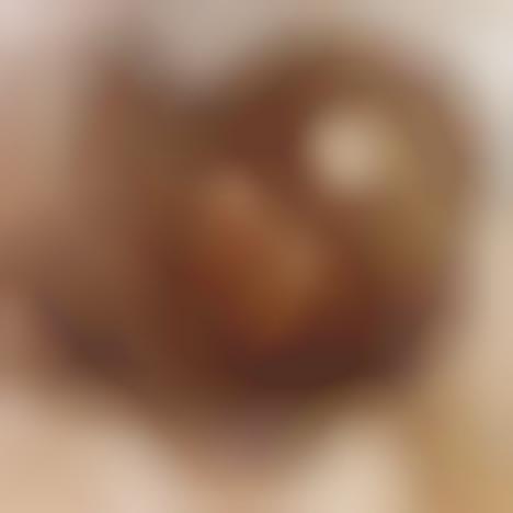 Stem Cell Breakthrough Uses Human Skin, Not Embryos