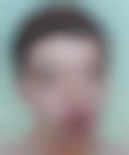 Bug-Eyed Portraits