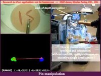 Gesture-Controlled Medical Robots Image 7