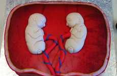 Pregnant Fetal Pastries