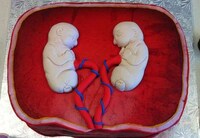 Pregnant Fetal Pastries