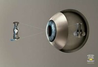 Skewed Perception PSAs Image 3