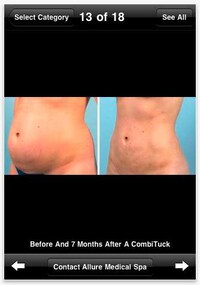 Plastic Surgery Apps Image 4