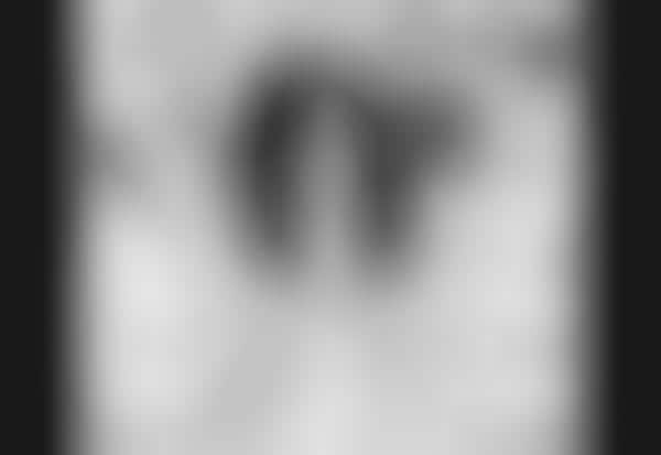 Peeper-Censored Pictorials