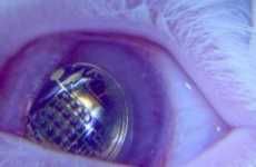 Bionic Contact Lenses