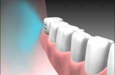 Take Your Medication Via Tooth Implant