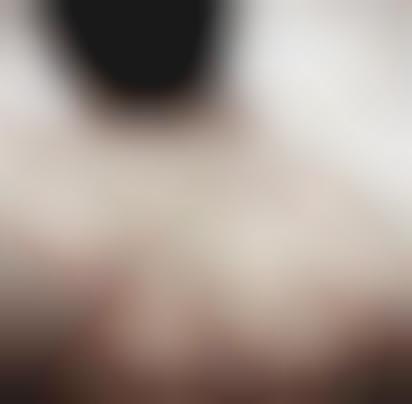 Skin Cancer Campaigns