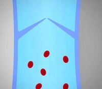Portable Blood Pumpers Image 7