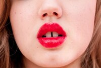 Buck-Tooth Beauty Shoots Image 2