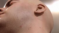 Video Game Skin Enhancers Image 4