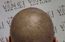 Inked-On Buzz Cuts