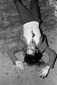 Wounded Model Editorials Image 4