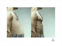 Agitating Aging Solution Ads Image 2