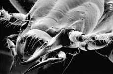 Camera Implants For Insects