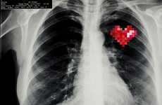 Pixelated Anatomy X-Rays