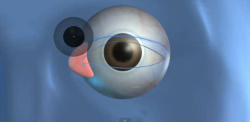 Augmented Reality Lenses
