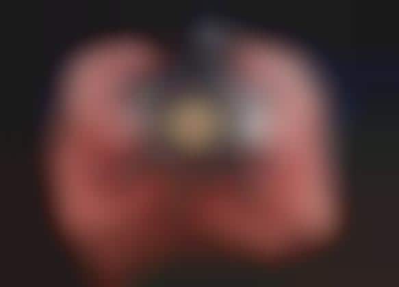 Pocket-Sized Distortion Lenses