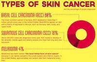 Sun Safety Scares Image 4