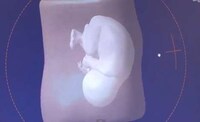 3D-Printed Fetuses Image 3