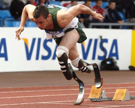 12 Hi-Tech Prosthetic Legs