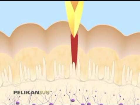 Painless Diabetes Testing