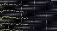 Telepathic Cyborgs Image 8