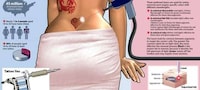 Ink Removal Guides Image 3