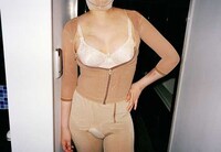 Post-Plastic Surgery Portraits Image 2