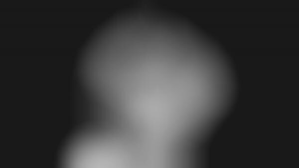 Sight-enabling Implants