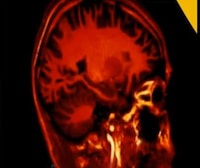 Image-Revealing Brain Scans  Image 6