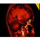 Image-Revealing Brain Scans  Image 6