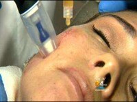 Blood-Recycling Beauty Facials Image 3