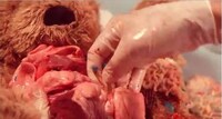 Stuffed Animal Surgery Videos Image 5