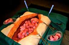 Surgery-Replicating Sweets