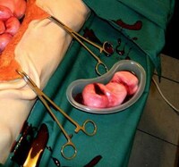 Disgusting Surgical Desserts Image 2