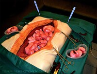 Disgusting Surgical Desserts Image 3