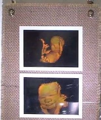 Surreal 3D Fetal Prints Image 4