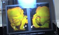 Surreal 3D Fetal Prints Image 8